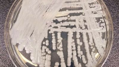 Image for story: More than half of states report spread of dangerous fungus